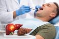 Как простая гигиена полости рта может снизить риск рака печени